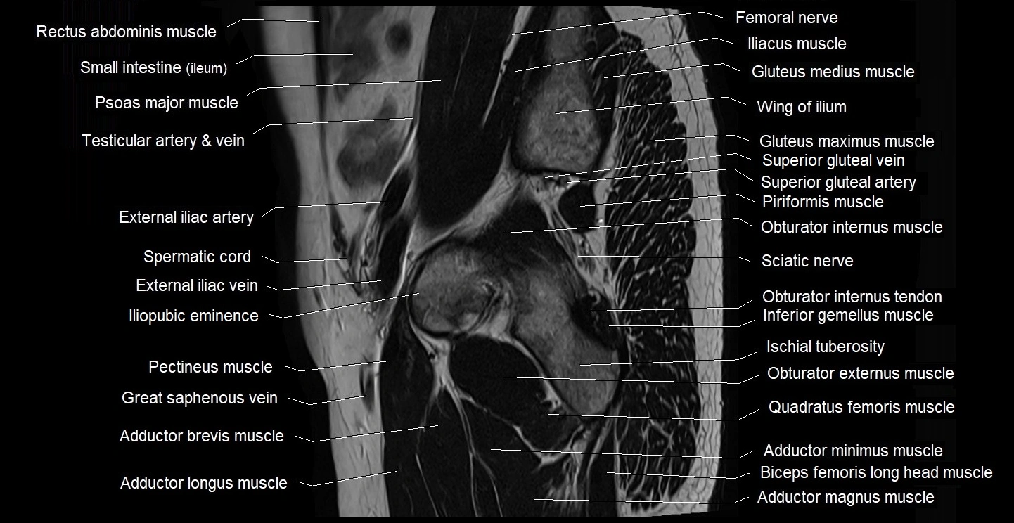 male pelvis sagittal cross sectional anatomy 3T mri image 40.webp